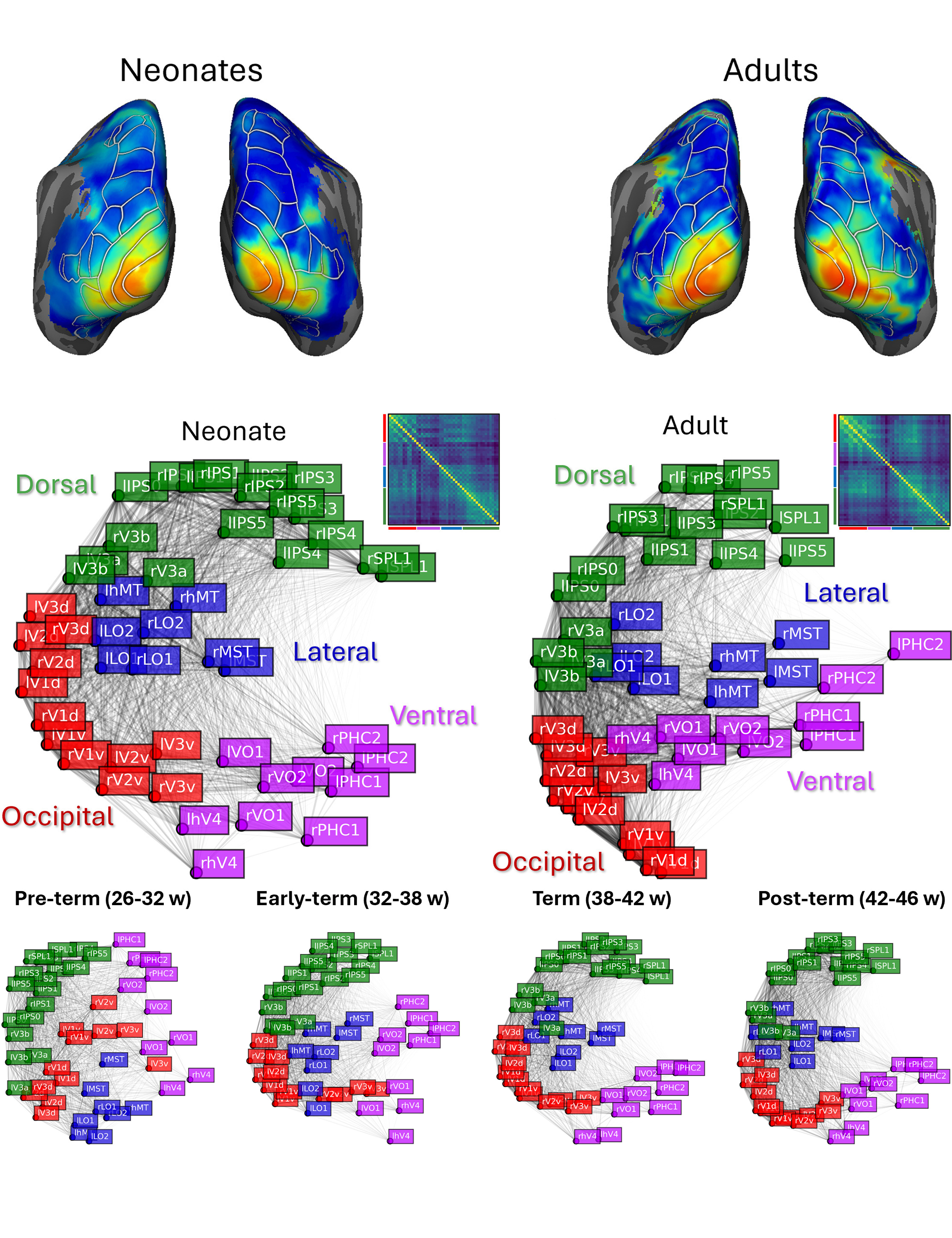 Functional organization of the human visual system at birth and across late gestation